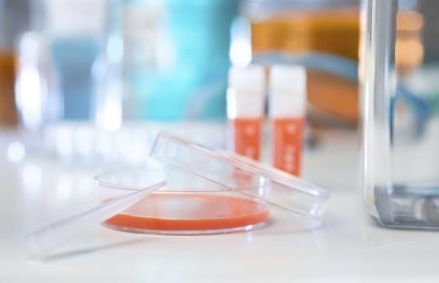 Smear listeria spp.