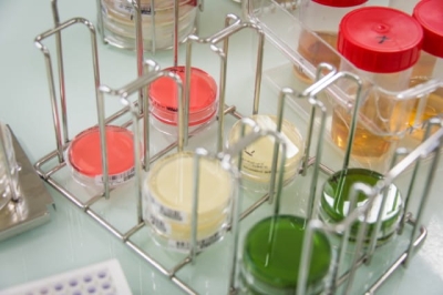 Bakterie redukujące siarczany