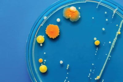 Badanie żywności - Bakterie z grupy Coli