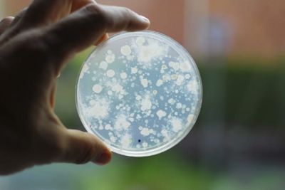 Bakterie kwasu mlekowego