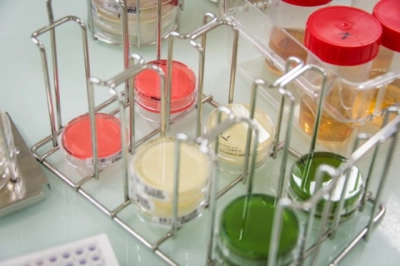 Bakterie redukujące siarczany - badanie przechowalnicze