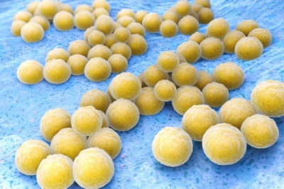 Smear coagulase-positive staphylococci (Staphylococcus aureus and other species)