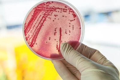 Clostridium perfringens