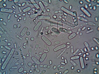 Obecność specyficznego DNA dla E.coli (STEC) - obecność w 25g