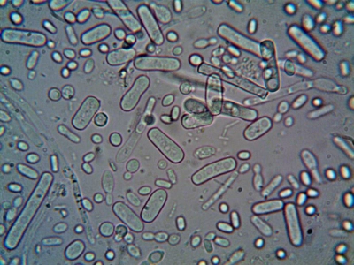 Obecność specyficznego DNA dla E.coli (STEC) - obecność w 25g