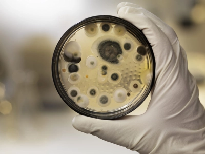 Presence of Listeria sp.DNA - smear
