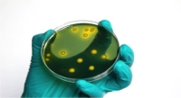 Staphylococcus aureus (Ph. Eur.)